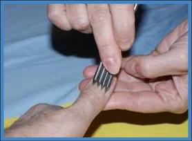 Klawiterapia1 - Sposób bodźcowania palca dłoni.jpg